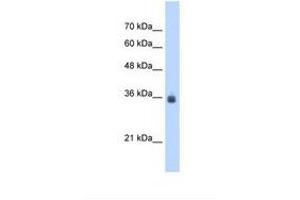Image no. 1 for anti-Stromal Cell Derived Factor 4 (SDF4) (AA 251-300) antibody (ABIN321227) (SDF4 antibody  (AA 251-300))