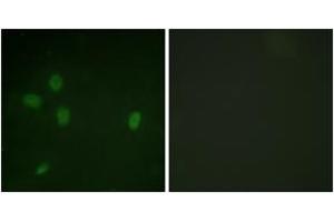 Immunofluorescence analysis of NIH-3T3 cells, using 53BP1 (Phospho-Ser25) Antibody. (TP53BP1 antibody  (pSer25))