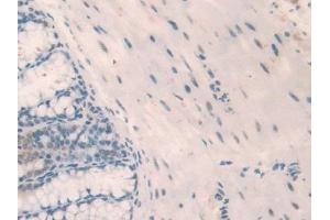 Immunohistochemistry (IHC) image for anti-Nucleophosmin (Nucleolar phosphoprotein B23, Numatrin) (NPM1) (AA 212-292) antibody (ABIN7438103)