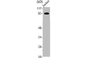 Western Blot analysis of Jurkat cells using cGKII Polyclonal Antibody (PRKG2 antibody  (Internal Region))