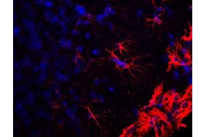Indirect immustaining of cortex section from PFA fixed mouse brain (dilution 1 : 500). (GFAP antibody)