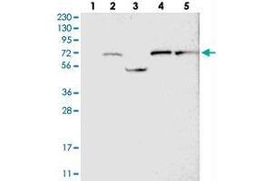 Western blot analysis of Lane 1: RT-4, Lane 2: U-251 MG, Lane 3: Human Plasma, Lane 4: Liver, Lane 5: Tonsil with GUCY1B3 polyclonal antibody  at 1:250-1:500 dilution.