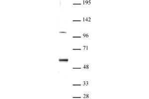 ELP3 antibody (pAb) tested by Western blot. (ELP3/KAT9 antibody  (N-Term))