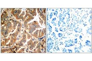 Image no. 1 for anti-Adducin 1 (Alpha) (ADD1) (Ser726) antibody (ABIN197406) (alpha Adducin antibody  (Ser726))