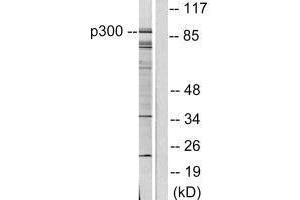 Western blot analysis of extracts from COLO205 cells, using P300/CBP antibody. (EP3/CREBBP antibody)