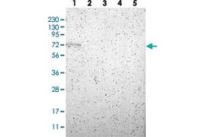Western blot analysis of Lane 1: RT-4, Lane 2: U-251 MG, Lane 3: Human Plasma, Lane 4: Liver, Lane 5: Tonsil with RBM47 polyclonal antibody  at 1:250-1:500 dilution. (RBM47 antibody)