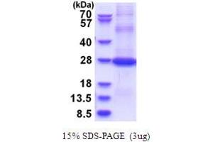 SDS-PAGE (SDS) image for CD200 (CD200) (AA 31-232) protein (His tag) (ABIN5853723)