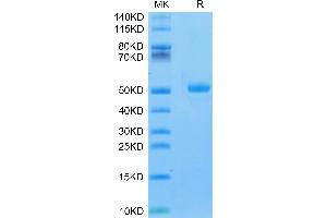 Mouse CA9/Carbonic Anhydrase IX on Tris-Bis PAGE under reduced condition. (CA9 Protein (AA 32-390) (His tag))