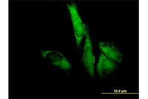 Immunofluorescence (IF) image for anti-Eukaryotic Translation Initiation Factor 3 Subunit F (EIF3F) (AA 1-357) antibody (ABIN522111)