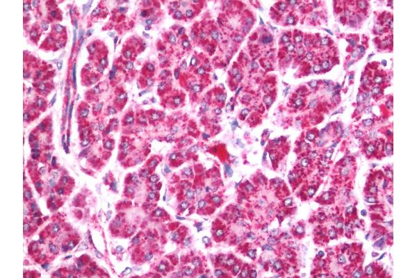 ASH1L antibody  (AA 2919-2969)