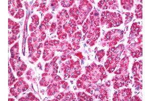 Human Pancreas: Formalin-Fixed, Paraffin-Embedded (FFPE) (ASH1L antibody  (AA 2919-2969))