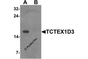 Western Blotting (WB) image for anti-T-Complex-Associated-Testis-Expressed 3 (TCTE3) (N-Term) antibody (ABIN1587949) (TCTE3 antibody  (N-Term))