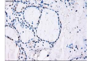 Immunohistochemical staining of paraffin-embedded Kidney tissue using anti-ID3mouse monoclonal antibody. (ID3 antibody)