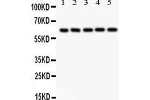 Western Blotting (WB) image for anti-SHC (Src Homology 2 Domain Containing) Transforming Protein 1 (SHC1) (AA 536-564), (C-Term) antibody (ABIN3043923) (SHC1 antibody  (C-Term))