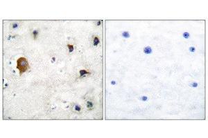 Immunohistochemistry (IHC) image for anti-Gap Junction Protein, alpha 1, 43kDa (GJA1) (C-Term) antibody (ABIN1848481) (Connexin 43/GJA1 antibody  (C-Term))