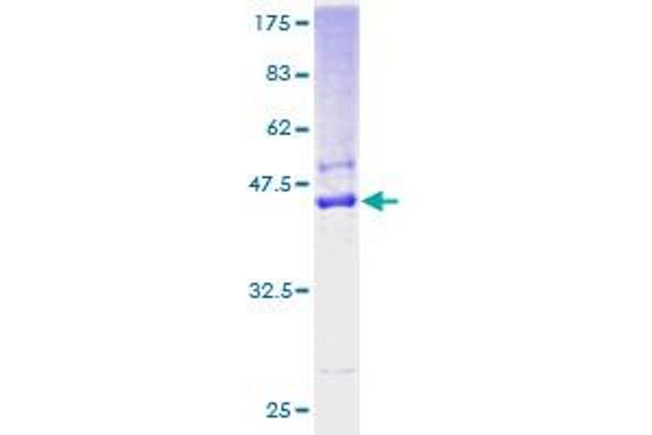 SSR4 Protein (AA 24-173) (GST tag)