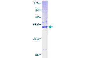 SSR4 Protein (AA 24-173) (GST tag)