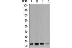 Western blot analysis of mPR expression in HepG2 (A), SW480 (B), mouse liver (C), mouse brain (D) whole cell lysates. (mPR antibody)