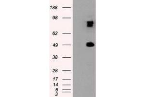 Western Blotting (WB) image for anti-Proteasome (Prosome, Macropain) 26S Subunit, ATPase, 3 (PSMC3) antibody (ABIN1501328)