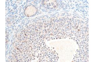 Immunohistochemistry (IHC) image for anti-Checkpoint Kinase 2 (CHEK2) (pThr387) antibody (ABIN6256554)
