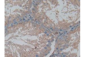DAB staining on IHC-P; Samples: Rat Testis Tissue (Cathepsin L antibody  (AA 114-288))