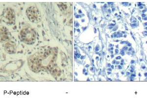 Image no. 1 for anti-Mdm2, p53 E3 Ubiquitin Protein Ligase Homolog (Mouse) (MDM2) (pSer166) antibody (ABIN401611) (MDM2 antibody  (pSer166))
