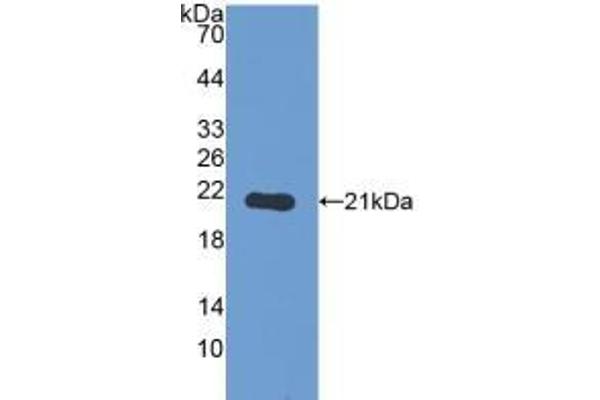 PYGL antibody  (AA 370-538)