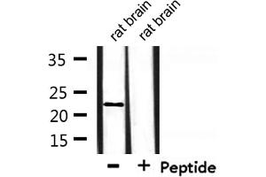 Western blot analysis of extracts from rat brain, using Recoverin Antibody.