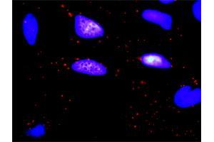 Proximity Ligation Analysis of protein-protein interactions between OSMR and ERBB2. (Oncostatin M Receptor antibody  (AA 1-342))