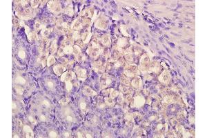 Paraformaldehyde-fixed, paraffin embedded Mouse Stomach, Antigen retrieval by boiling in sodium citrate buffer (pH6. (SYK antibody  (pTyr323))