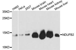 Western blot analysis of extracts of various cell lines, using NDUFB2 antibody (ABIN5972152) at 1:3000 dilution. (NDUFB2 antibody)