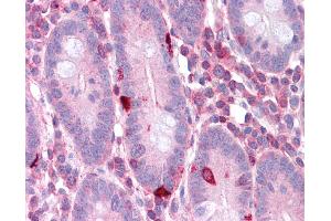Immunohistochemistry (IHC) image for anti-Eukaryotic Translation Elongation Factor 2 (EEF2) (N-Term) antibody (ABIN2787690) (EEF2 antibody  (N-Term))