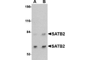 Western Blotting (WB) image for anti-SATB Homeobox 2 (SATB2) (C-Term) antibody (ABIN1030643) (SATB2 antibody  (C-Term))