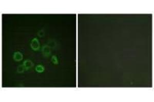 Immunofluorescence analysis of LOVO cells, using Bax (Ab-167) antibody. (BAX antibody  (Thr167))