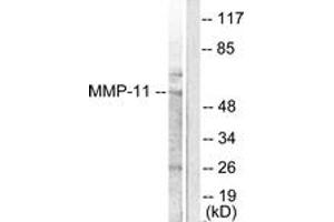 Western blot analysis of extracts from A549 cells, using MMP-11 Antibody. (MMP11 antibody  (AA 61-110))