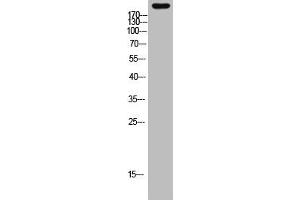 Western Blot analysis of mouse-heart cells using primary antibody diluted at 1:2000(4 °C overnight). (MYH6 antibody  (AA 341-390))