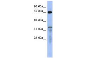 Image no. 1 for anti-RAP1 GTPase Activating Protein (RAP1GAP) (AA 503-552) antibody (ABIN6744090) (RAP1GAP antibody  (AA 503-552))