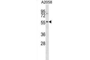 Western Blotting (WB) image for anti-BTB (POZ) Domain Containing 14A (BTBD14A) antibody (ABIN2998943) (BTBD14A antibody)