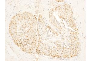 Immunohistochemistry (IHC) image for anti-Stromal Antigen 1 (STAG1) (AA 1125-1175) antibody (ABIN7454841)