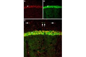 BDNF co-localizes with TrkB in mouse hippocampal CA1 region.