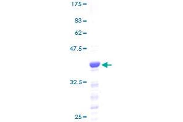 HMGN2 Protein (AA 1-90) (GST tag)