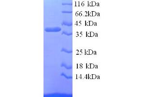 SDS-PAGE (SDS) image for Pregnancy Zone Protein (PZP) (AA 472-821), (partial) protein (His tag) (ABIN4985335)