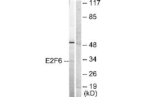 Western blot analysis of extracts from HepG2 cells, usingantibody (#C0179). (E2F6 antibody)