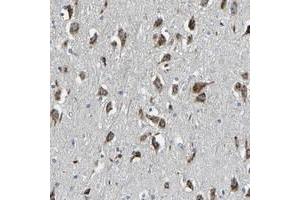 Immunohistochemical staining of human hippocampus with FAM174A polyclonal antibody  shows strong cytoplasmic positivity with a granular pattern in neuronal cells at 1:50-1:200 dilution. (FAM174A antibody)