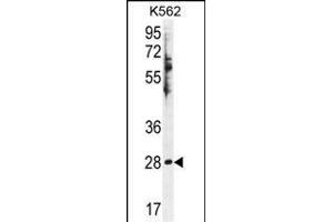 HSD11B1L Antibody (C-term) (ABIN655425 and ABIN2844963) western blot analysis in K562 cell line lysates (35 μg/lane). (HSD11B1L antibody  (C-Term))