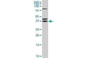RDHE2 monoclonal antibody (M01), clone 3G8. (SDR16C5 antibody  (AA 26-309))