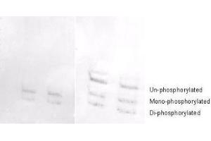 Western Blotting (WB) image for anti-Myosin, Light Chain 12A, Regulatory, Non-Sarcomeric (MYL12A) (N-Term) antibody (ABIN104491)