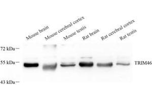 Western blot analysis of TRIM46 (ABIN7076020) at dilution of 1: 2000 (TRIM46 antibody)