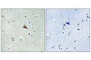 Immunohistochemistry analysis of paraffin-embedded human brain tissue using Trk A (Phospho-Tyr701) antibody. (TRKA antibody  (pTyr701))