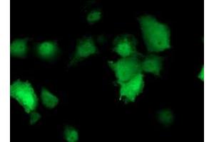 Anti-TMOD1 mouse monoclonal antibody (ABIN2454777) immunofluorescent staining of COS7 cells transiently transfected by pCMV6-ENTRY TMOD1 (RC201134). (Tropomodulin 1 antibody)